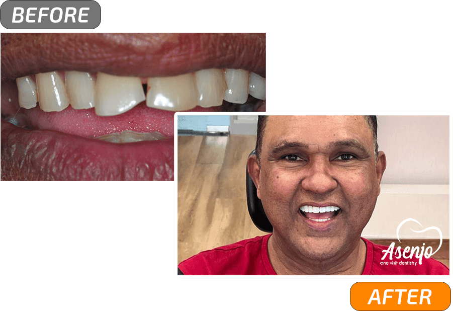 Dental implants and Graphene dentistry